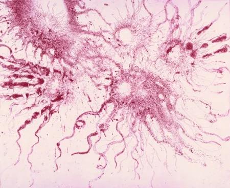 Acquaforte E Acquatinta Barcelo - Lanzarote 20