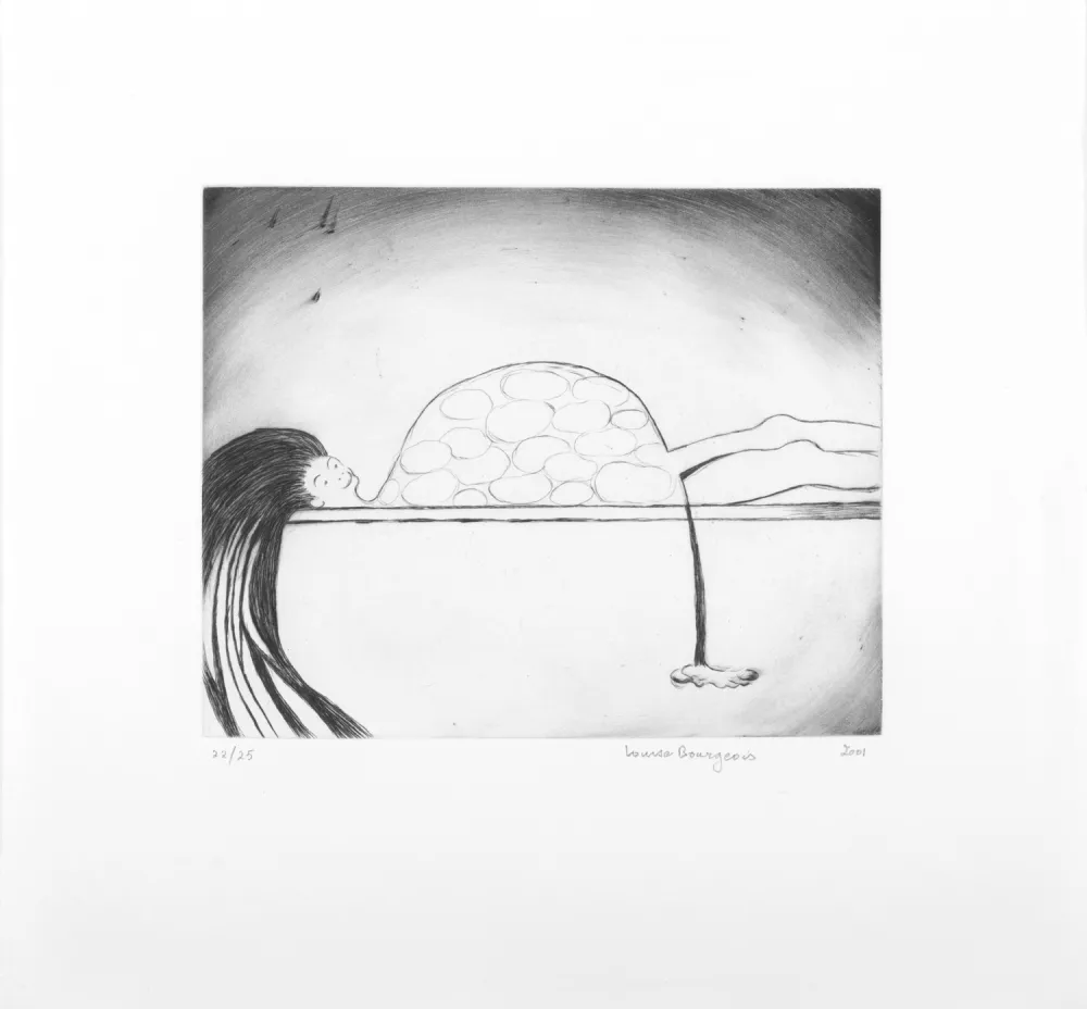 Incisione Bourgeois - Medical Print