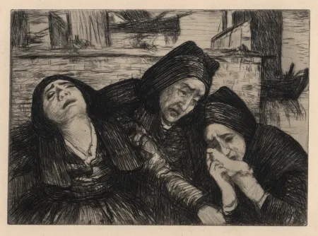 Incisione Cottet - Douleur