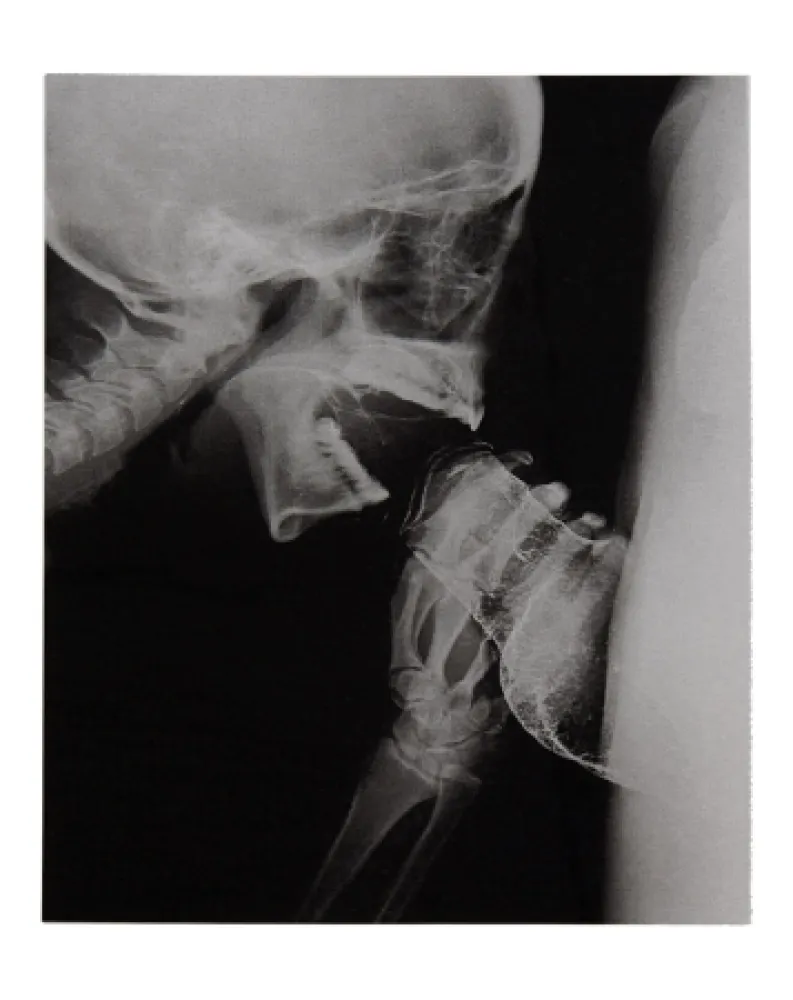 Libro Illustrato Delvoye - Sexrays