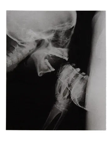 Libro Illustrato Delvoye - Sexrays