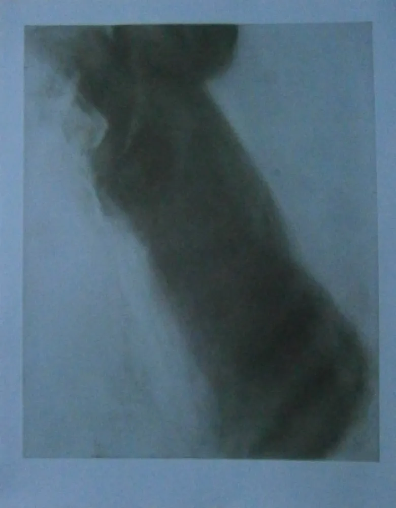 Acquaforte Garache - Bleue