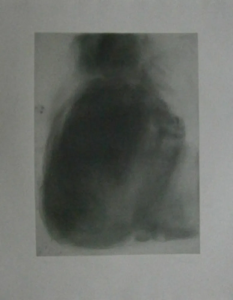 Acquaforte Garache - Tourette