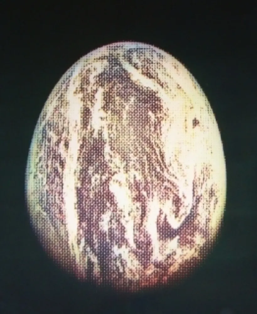 Acquaforte E Acquatinta Jacquet - L'oeuf