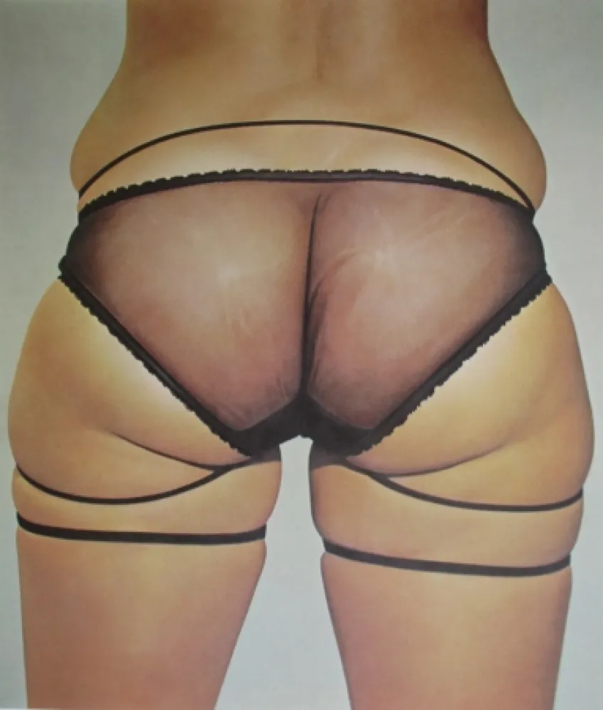 Litografia Kacere - Loretta 