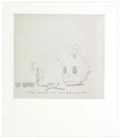 Incisione Kaga - The new nose for Micheal Jackson's