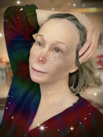 Multiplo Sherman - Untitled (Twinkle-Nose)